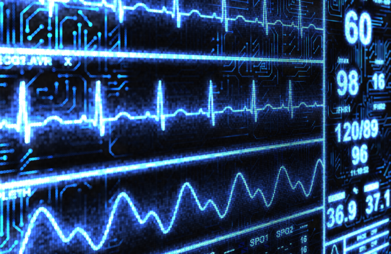 Cardiac Ablation Procedure
